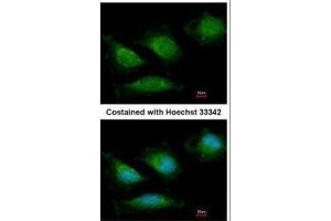 ICC/IF Image Immunofluorescence analysis of methanol-fixed HeLa, using DNA polymerase gamma, antibody at 1:200 dilution. (POLG 抗体  (C-Term))