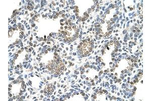 TST antibody was used for immunohistochemistry at a concentration of 4-8 ug/ml to stain Alveolar cells (arrows) in Human Lung. (TST 抗体)
