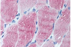 anti-ADP Ribosylation Factor Like GTPase 6 (ARL6) (N-Term) antibody