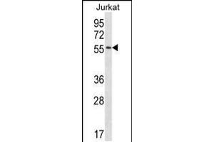 Western blot analysis in Jurkat cell line lysates (35ug/lane). (C1RL 抗体  (AA 161-190))