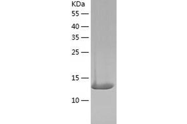 ARPC5 Protein (AA 1-151) (His tag)