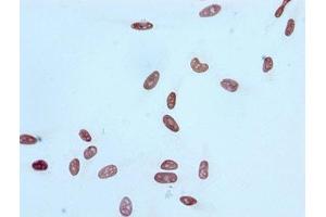 Immunocytochemistry analysis of ABIN7127270 diluted at 1:100 and staining in Hela cells performed on a Leica BondTM system. (Recombinant HIST1H4A 抗体  (acLys16))