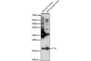 Western blot analysis of extracts of various cell lines, using TTR Rabbit mAb (ABIN1682449, ABIN3018489, ABIN3018490 and ABIN7101619) at 1:1000 dilution. (TTR 抗体)