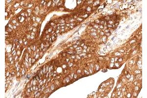 ABIN6268729 at 1/100 staining human Stomach tissue sections by IHC-P. (Cathepsin E 抗体  (Internal Region))