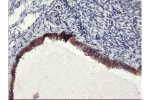 Immunohistochemical staining of paraffin-embedded Human Ovary tissue using anti-FBXO21 mouse monoclonal antibody. (FBXO21 抗体)