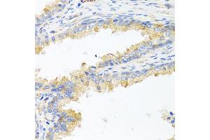 Immunohistochemistry of paraffin-embedded human prostate using ApoE antibody (ABIN5975768) at dilution of 1/100 (40x lens). (APOE 抗体)