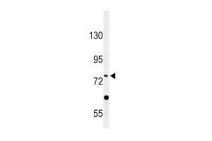 Western blot analysis of PLA2G6 Antibody (Center) (ABIN653895 and ABIN2843138) in HepG2 cell line lysates (35 μg/lane). (PLA2G6 抗体  (AA 551-580))