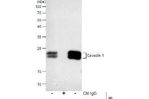 IP Image Immunoprecipitation of Caveolin 1 protein from A549 membrane extracts using 5 μg of Caveolin 1 antibody [N1N3], Western blot analysis was performed using Caveolin 1 antibody [N1N3], EasyBlot anti-Rabbit IgG  was used as a secondary reagent. (Caveolin-1 抗体  (N-Term))