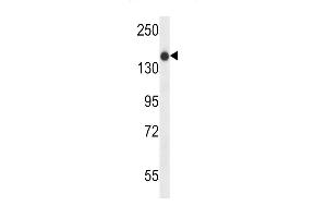 XIRP1 Antibody (C-term) (ABIN657535 and ABIN2846553) western blot analysis in NCI- cell line lysates (35 μg/lane). (XIRP1 抗体  (C-Term))