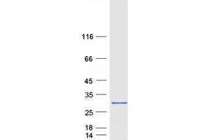 Validation with Western Blot