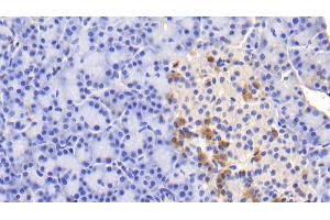 Detection of INSR in Human Pancreas Tissue using Polyclonal Antibody to Insulin Receptor (INSR) (Insulin Receptor 抗体  (AA 1024-1298))