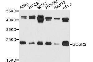 Western blot analysis of extracts of various cells, using GOSR2 antibody. (GOSR2 抗体)