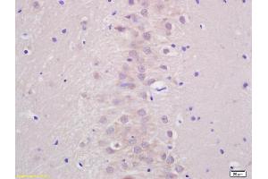 Formalin-fixed and paraffin embedded rat brain labeled with Anti-ATP7B Polyclonal Antibody, Unconjugated (ABIN733433) at 1:200 followed by conjugation to the secondary antibody and DAB staining.