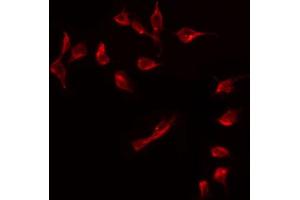 ABIN6274920 staining COLO205 by IF/ICC. (BMP8A 抗体  (Internal Region))