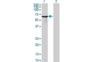 Western Blot analysis of L3MBTL4 expression in transfected 293T cell line by L3MBTL4 monoclonal antibody (M01), clone 1B9-1C12. (L3MBTL4 抗体  (AA 1-534))