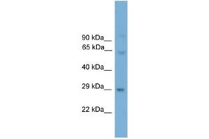 WB Suggested Anti-Prrx2 Antibody Titration:  0. (PRRX2 抗体  (N-Term))