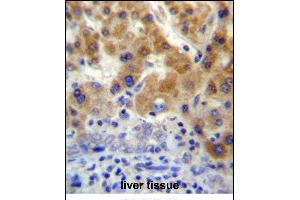 NT5C3L Antibody (N-term) (ABIN657206 and ABIN2846319) immunohistochemistry analysis in formalin fixed and paraffin embedded human liver tissue followed by peroxidase conjugation of the secondary antibody and DAB staining. (NT5C3L 抗体  (N-Term))