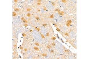 Immunohistochemistry of paraffin embedded rat brain using erf1 (ABIN7073895) at dilution of 1: 2400 (400x lens) (ETF1 抗体)