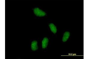 Immunofluorescence of purified MaxPab antibody to KCTD15 on HeLa cell. (KCTD15 抗体  (AA 1-234))