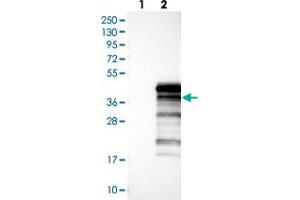 Western blot analysis of Lane 1: Negative control (vector only transfected HEK293T lysate), Lane 2: Over-expression Lysate (Co-expressed with a C-terminal myc-DDK tag (~3. (UBXN10 抗体)