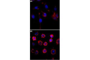 Immunocytochemistry staining of serum-starved A431 cells (A) and serum-starved A431 cells treated with EGF (B) using Phosphotyrosine monoclonal antibody, clone RM111  (Red) at 1:500 dilution. (Phosphotyrosine 抗体)