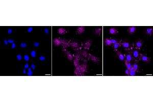 Immunocytochemical staining of HT- cells with Cadherin 6 antibody (ABIN7799153), 1:1,000).