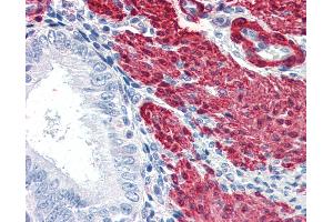 Anti-TAGLN / SM22 antibody IHC of human uterus. (Transgelin 抗体  (AA 190-201))