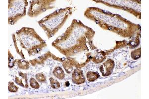 IHC analysis of GALE using anti-GALE antibody . (GALE 抗体  (AA 1-340))