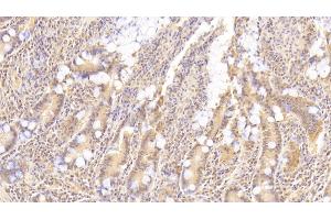 Detection of LIF in Human Small intestine Tissue using Monoclonal Antibody to Leukemia Inhibitory Factor (LIF)