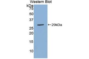 Western blot analysis of the recombinant protein. (IKbIP 抗体  (AA 78-301))
