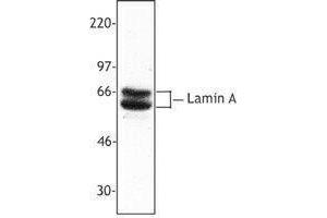 Western Blotting (WB) image for anti-Lamin A/C (LMNA) antibody (ABIN2666171) (Lamin A/C 抗体)