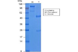 SDS-PAGE Analysis of Purified Cytokeratin 8 Rabbit Recombinant Monoclonal Antibody (KRT8/2174R).