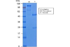 SDS-PAGE Analysis of Purified Cytokeratin 8 Rabbit Recombinant Monoclonal Antibody (KRT8/2174R). (Recombinant KRT8 抗体)