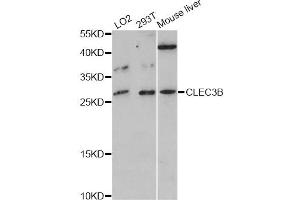Western blot analysis of extracts of various cell lines, using CLEC3B antibody (ABIN5997462) at 1:3000 dilution. (CLEC3B 抗体)