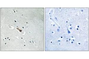 Immunohistochemistry analysis of paraffin-embedded human brain, using APLP2 (Phospho-Tyr755) Antibody. (APLP2 抗体  (pTyr755))