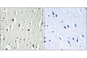 Immunohistochemistry analysis of paraffin-embedded human brain tissue, using CSK (Ab-364) Antibody. (CSK 抗体  (AA 330-379))