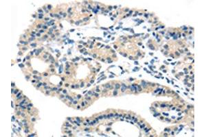 Immunohistochemistry (IHC) image for anti-Solute Carrier Family 16, Member 11 (Monocarboxylic Acid Transporter 11) (SLC16A11) antibody (ABIN7192395)