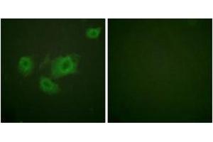 Immunofluorescence analysis of HuvEc cells, using Kir6. (KCNJ11 抗体  (pThr224))
