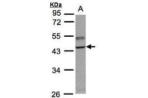 WB Image Sample(30 ug whole cell lysate) A:Raji , 10% SDS PAGE antibody diluted at 1:3000