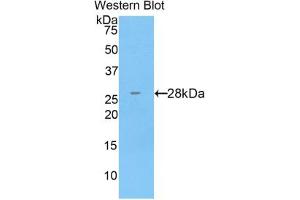 Western blot analysis of the recombinant protein. (CTSC 抗体  (AA 231-463))