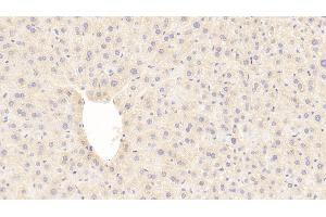 Detection of GLb in Mouse Liver Tissue using Polyclonal Antibody to Galactosidase Beta (GLb) (GLB1 抗体  (AA 192-432))