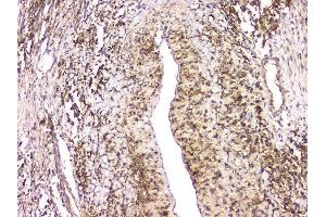 IHC analysis of HECTD3 using anti-HECTD3 antibody (ABIN6719595). (HECTD3 抗体)