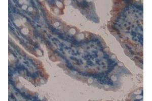 Immunohistochemistry (IHC) image for anti-Lectin, Galactoside-Binding, Soluble, 9 (LGALS9) (AA 225-353) antibody (ABIN7438190)