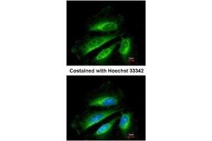 Immunofluorescence (IF) image for anti-Succinate Dehydrogenase Complex, Subunit B, Iron Sulfur (Ip) (SDHB) (C-Term) antibody (ABIN2855873)