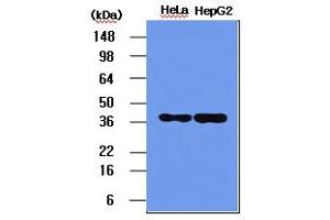 Western blot analysis: The HeLa and HepG2 cell lysates (5ug) were resolved by SDS-PAGE, transferred to PVDF membrane and probed with anti-human NPM (1:1000). (NPM1 抗体)