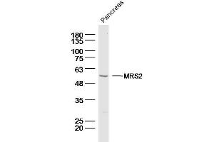 Mouse pancreas lysates probed with MRS2 Polyclonal Antibody, Unconjugated  at 1:300 dilution and 4˚C overnight incubation. (MRS2 抗体  (AA 201-300))