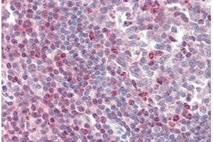 Human Tonsil (formalin-fixed, paraffin-embedded) stained with ZAP70 antibody ABIN461961 at 20 ug/ml followed by biotinylated anti-mouse IgG secondary antibody ABIN481714, alkaline phosphatase-streptavidin and chromogen. (ZAP70 抗体)