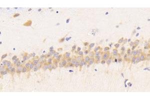 Detection of RETN in Rat Cerebrum Tissue using Polyclonal Antibody to Resistin (RETN) (Resistin 抗体  (AA 45-114))