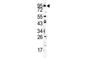 Western Blotting (WB) image for anti-Toll-Like Receptor 6 (TLR6) (AA 722-753) antibody (ABIN3029176)