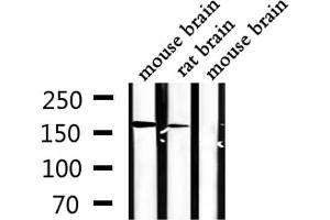 Western blot analysis of extracts from mouse brain,rat brain, using STK36 Antibody. (STK36 抗体  (Internal Region))